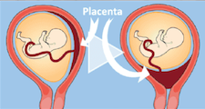 third-trimester